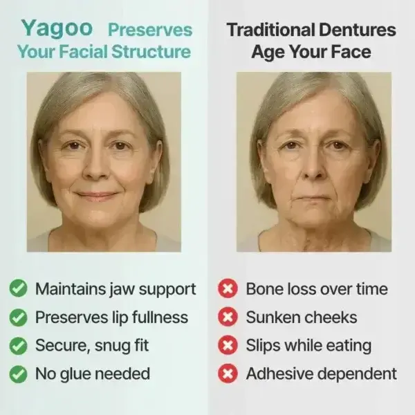 Medical Full Denture with Strong Suctiond - Image 21