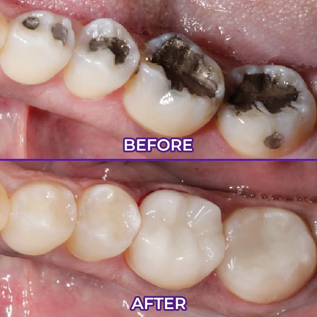 VioletX Advanced Whitening Complex - Image 2