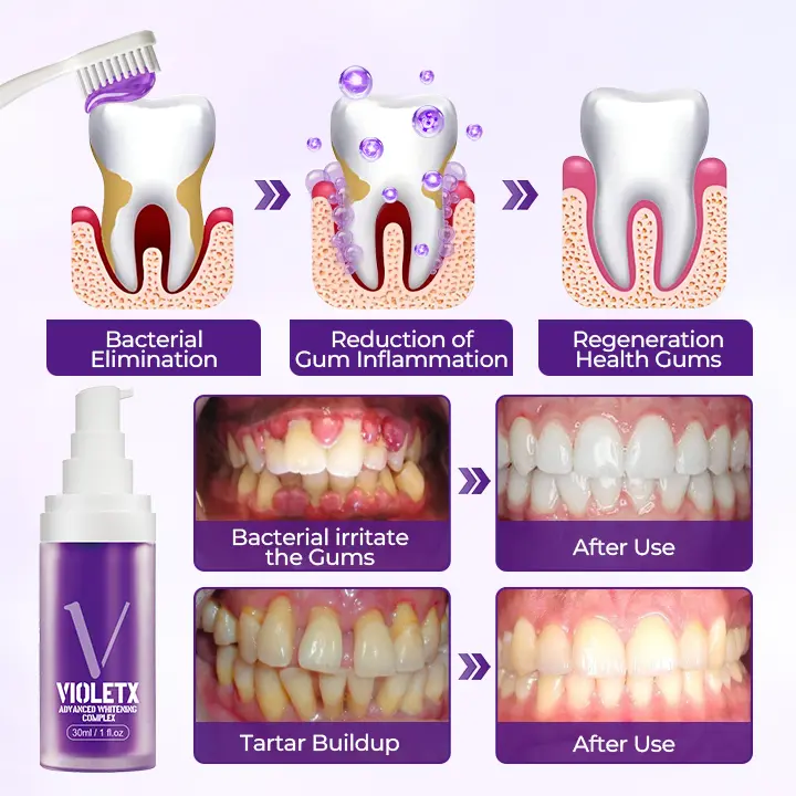 VioletX Advanced Whitening Complex - Image 6