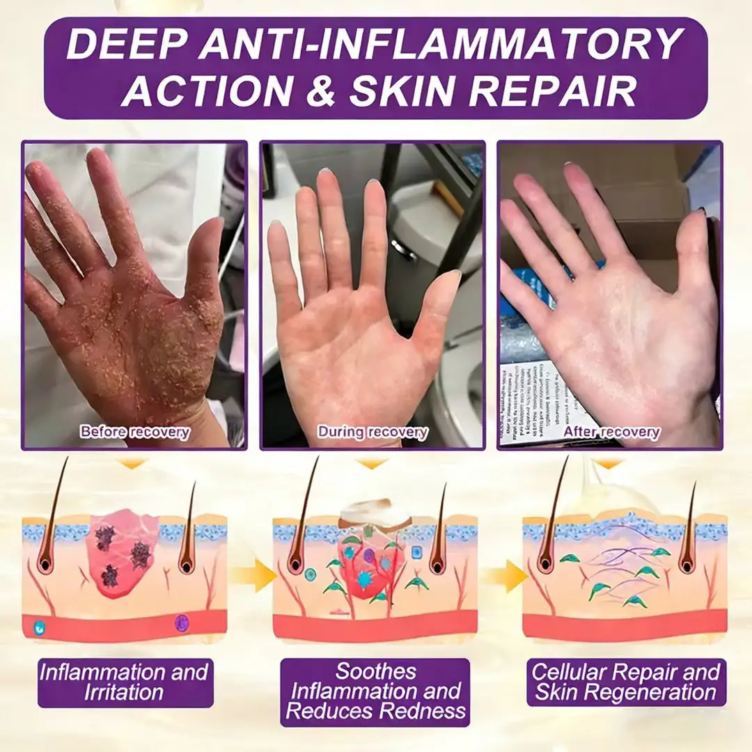 Biotin 10-in-1 Skin Restoration Cream - Image 11