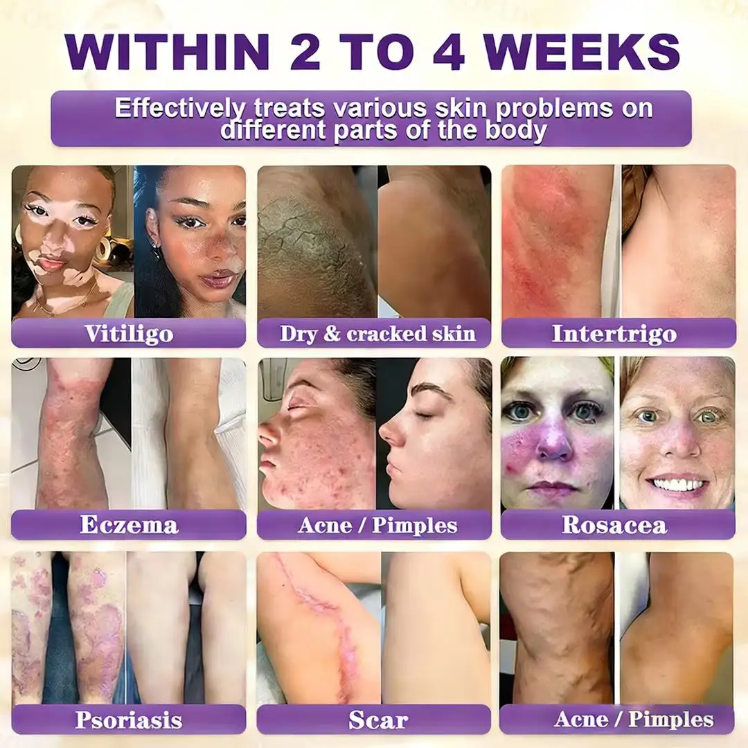 Biotin 10-in-1 Skin Restoration Cream - Image 2