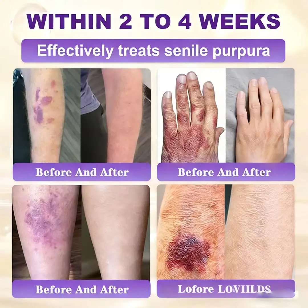 Biotin 10-in-1 Skin Restoration Cream - Image 3