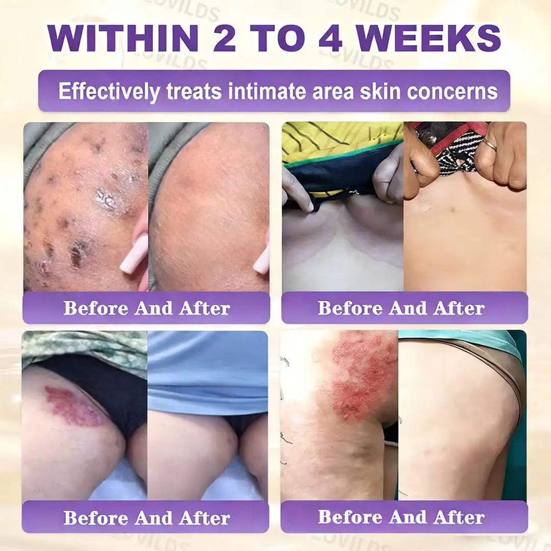 Biotin 10-in-1 Skin Restoration Cream - Image 4