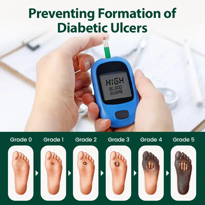 GlucoDerm Regenerative Foot Cream - Image 2