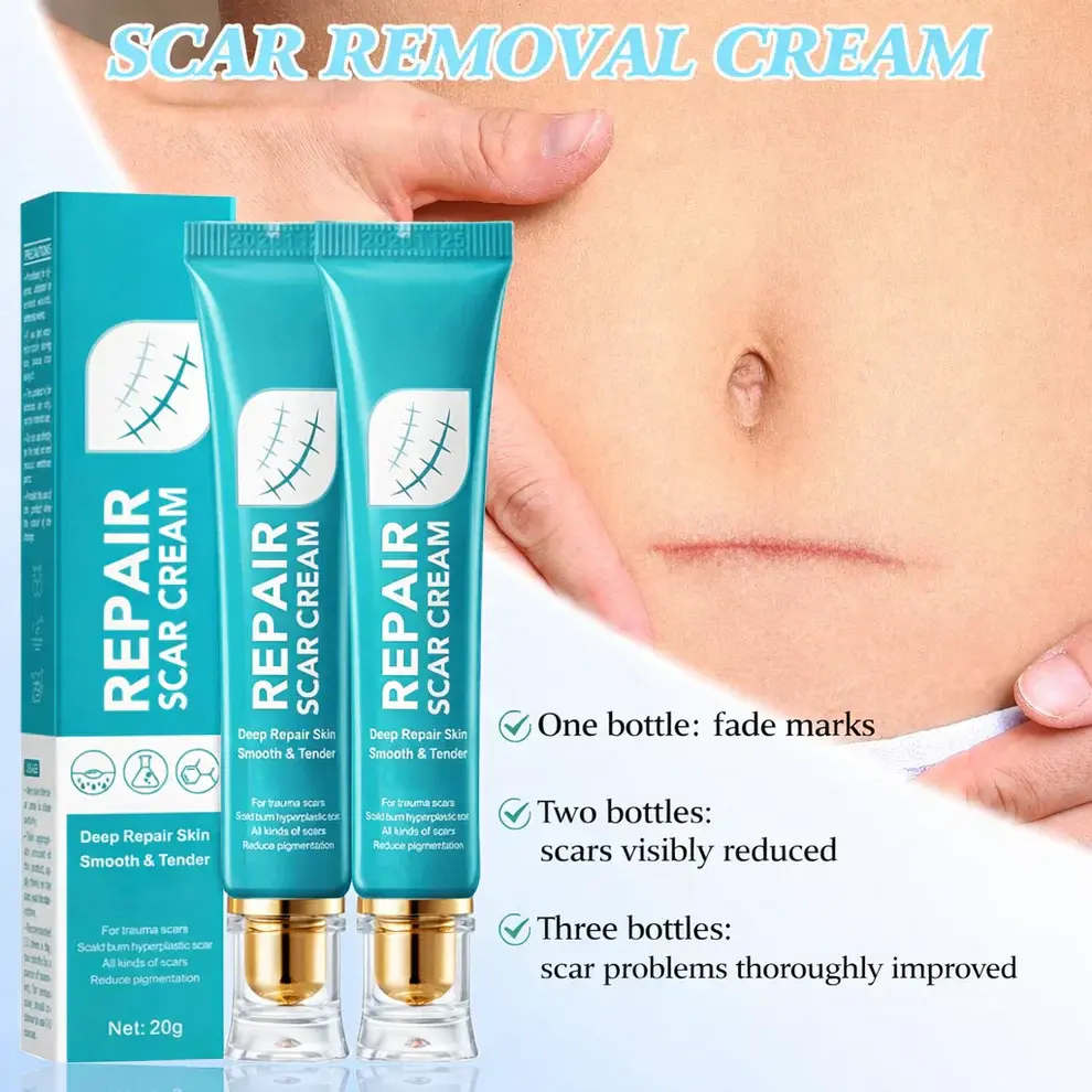 Alisanda Scar Repair Cream - Image 2