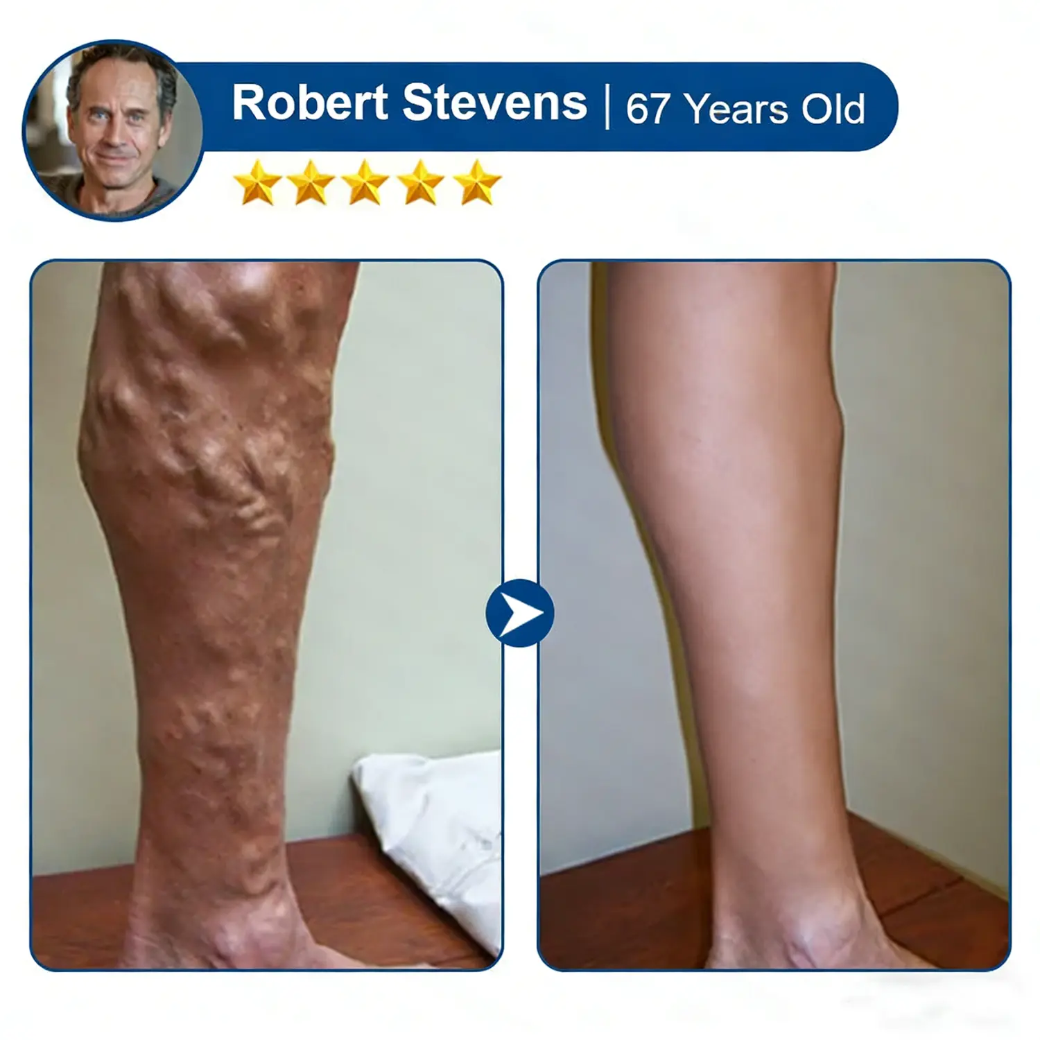 Skip Costly Procedures — Find Relief With One Easy Patch! - Image 12