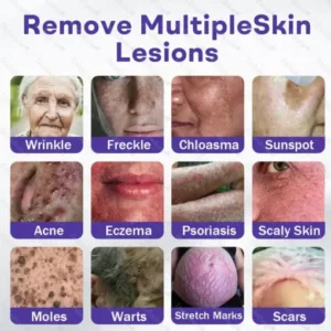 Alternative view of Wart and mole removal microneedle patch