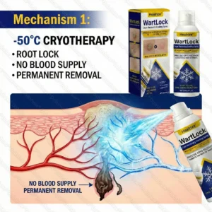 Alternative view of Wart Lock Cryo-Recovery Cooling Spray