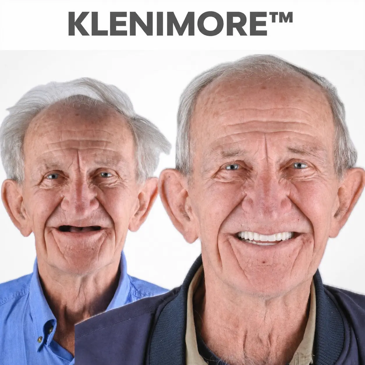 ⏰ Custom-Fit Dentures ENDS TODAY 70% OFF | Smile with Confidence - Image 8