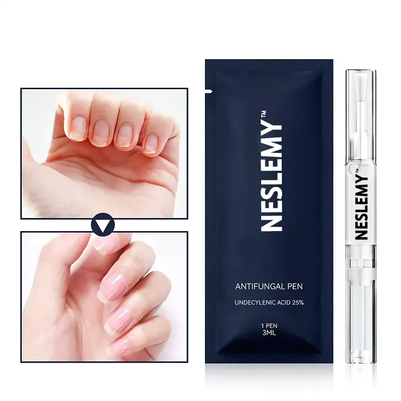 Antifungal Pen – 25% Undecylenic Acid Treatment for Athlete’s Foot &Skin Fungus - Image 4