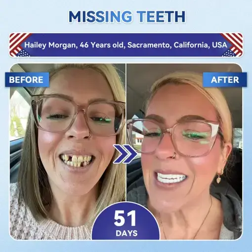 Tooth & Gum Repair Patch - Image 3