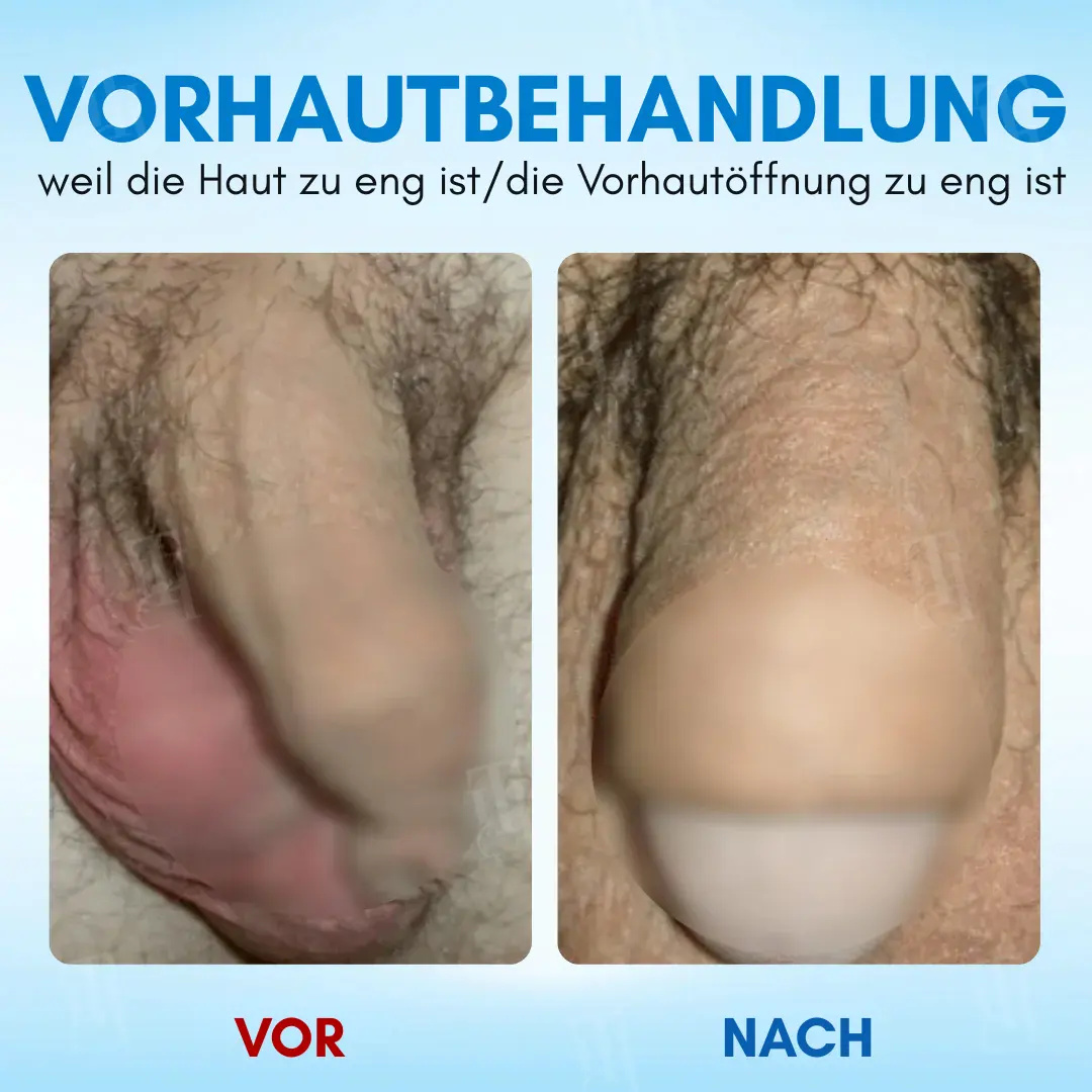 Gel :Zellaktives Bio-Tech Gel für Elastizität & Systemische Vitalität - Image 2