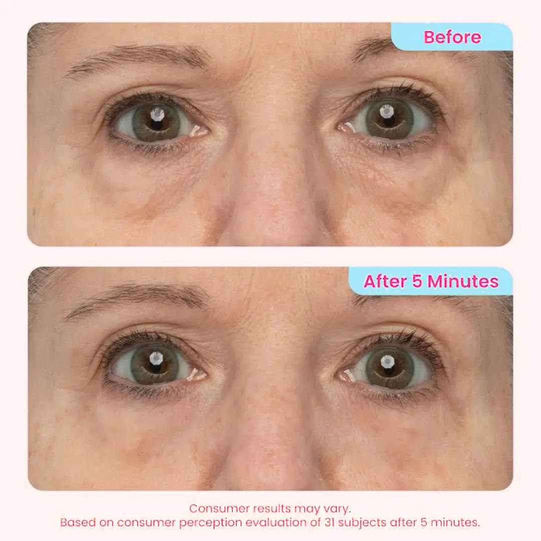 Instant Eye Tightening Gel - Image 4