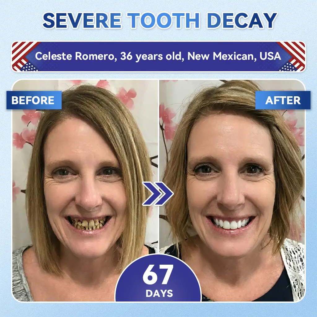 Tideglusib Fast‑Dissolving Tooth & Gum Repair Oral Strips - Image 11