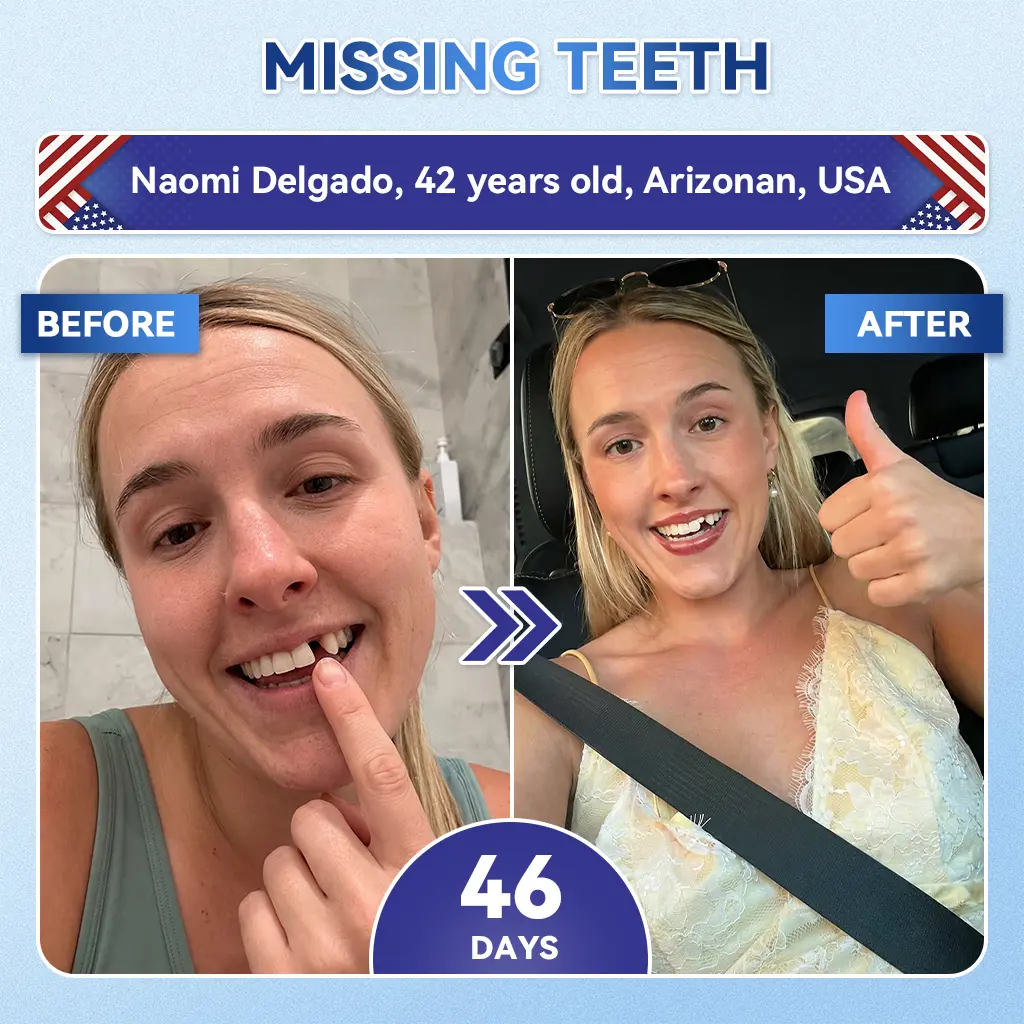 Tideglusib Fast‑Dissolving Tooth & Gum Repair Oral Strips - Image 14
