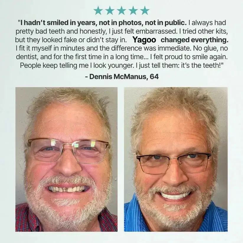 Custom-Fit Dentures— Designed for Comfort and a Natural-Looking Smile - Image 17