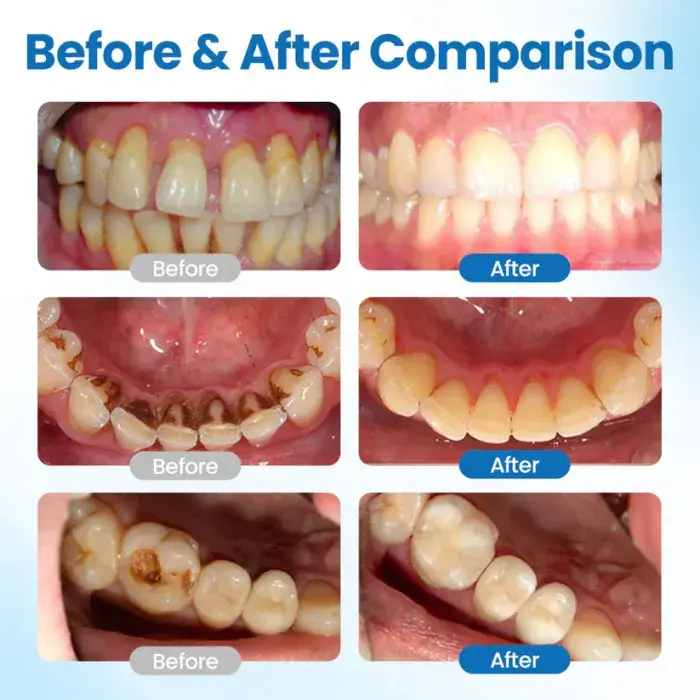 NanoHAP Tooth Defense Serum - Image 4